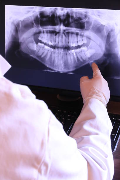 Best Emergency Dental Extractions in Newport, OH